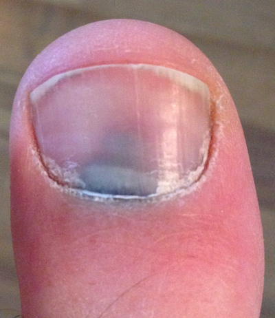 toe.jpg